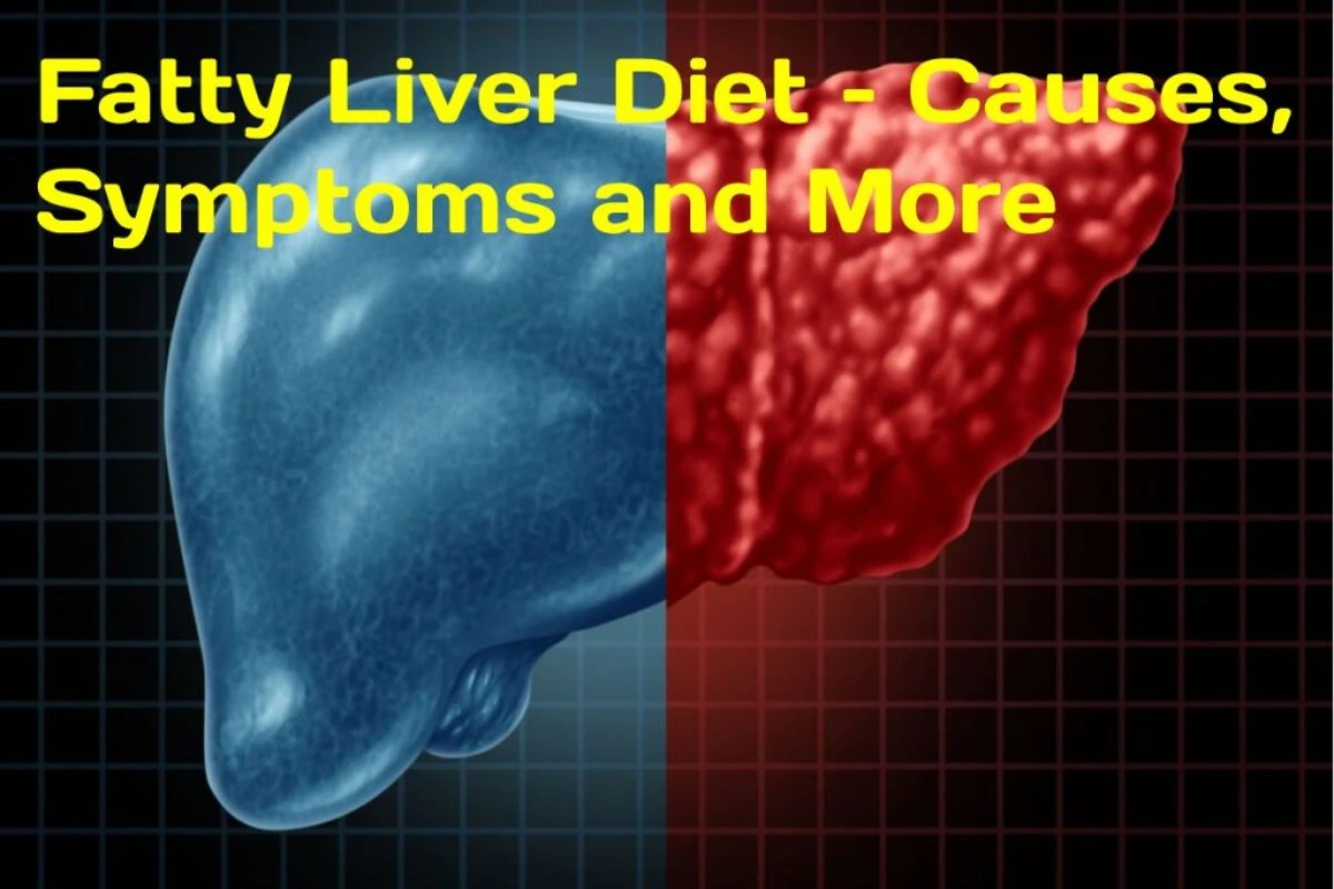 Fatty Liver Diet – Causes, Symptoms and More