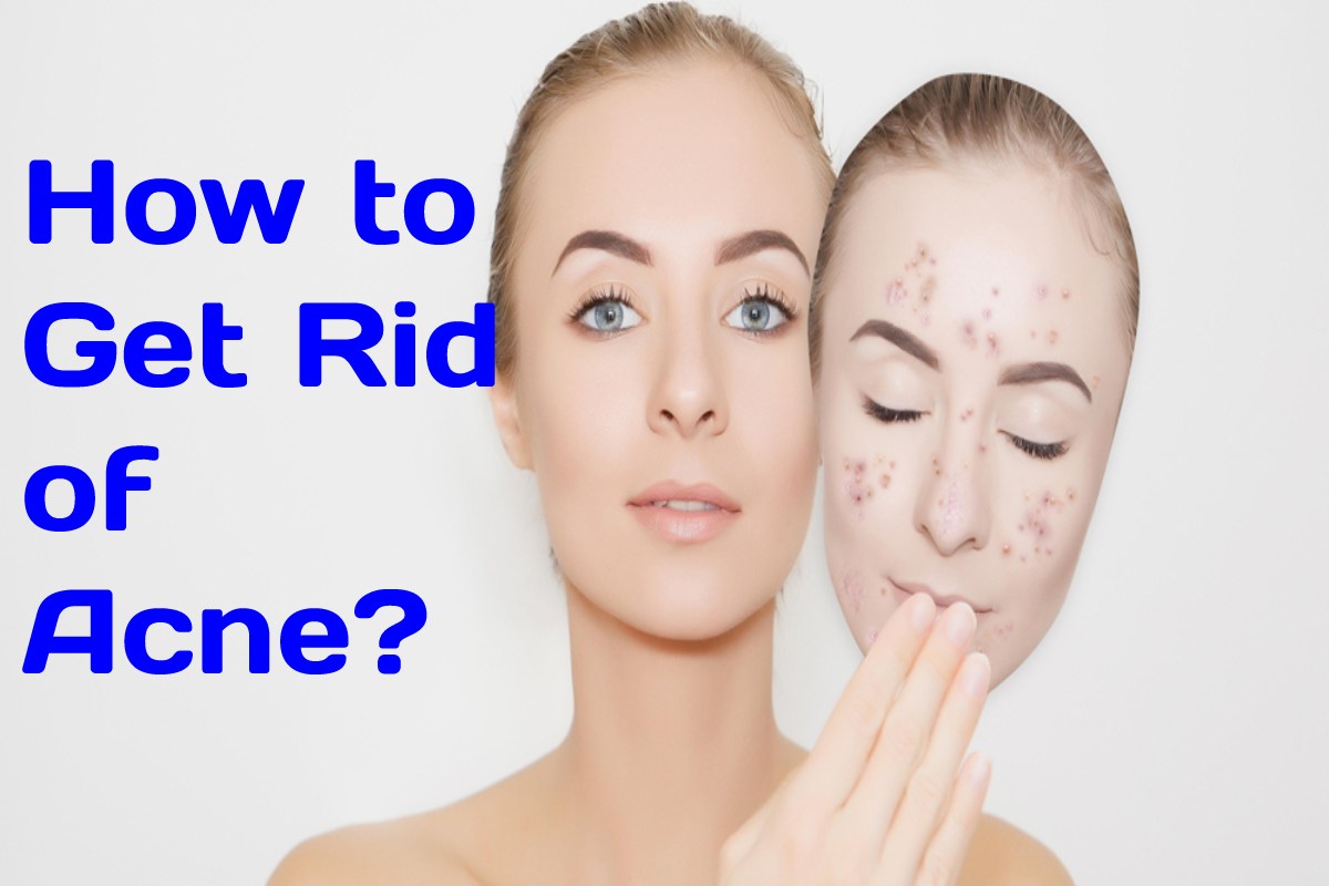 How To Get Rid Of Acne 