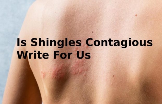 Is Shingles Contagious Write For Us - Guest Post, Contribute, and ...